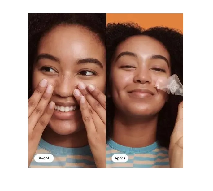 Hero. Mighty Patch NOSE náplasti na akné a černé tečky na nos 10ks - Obrázek 3